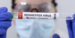 Afrique : 24 272 cas de mpox depuis le début de l’année 2025